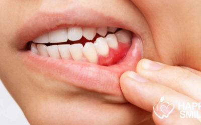 Santé bucco-dentaire et bien-être: Comment prévenir les maladies des gencives et garder un sourire sain