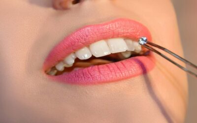 Pose de Strass Dentaire à Lausanne : Éclat, Sécurité et Personnalisation avec Happy Smile