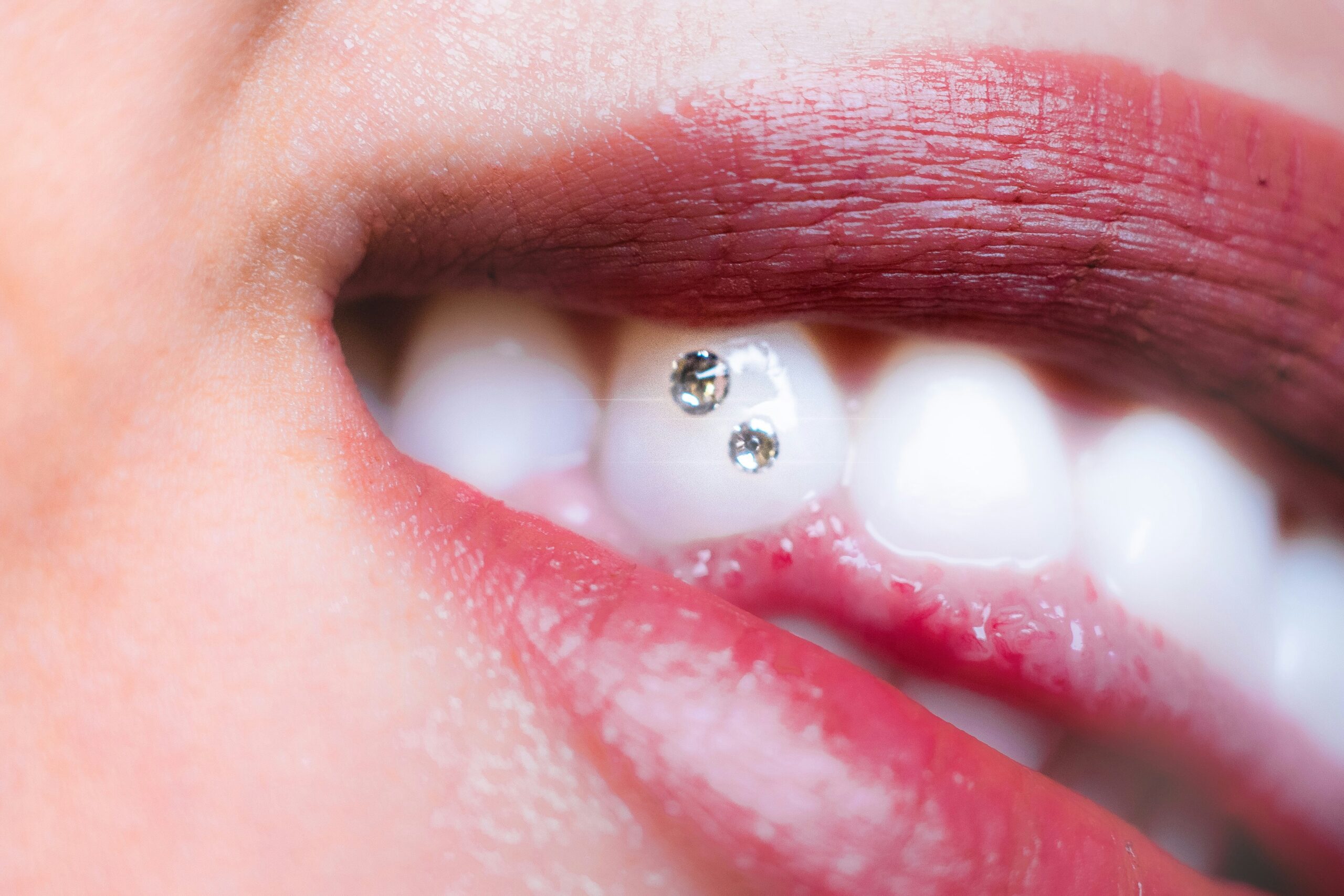 luigi-estuye-lucreative-Abck-EjJUjM-unsplash maintien parodontal pour éviter les gencive irritées