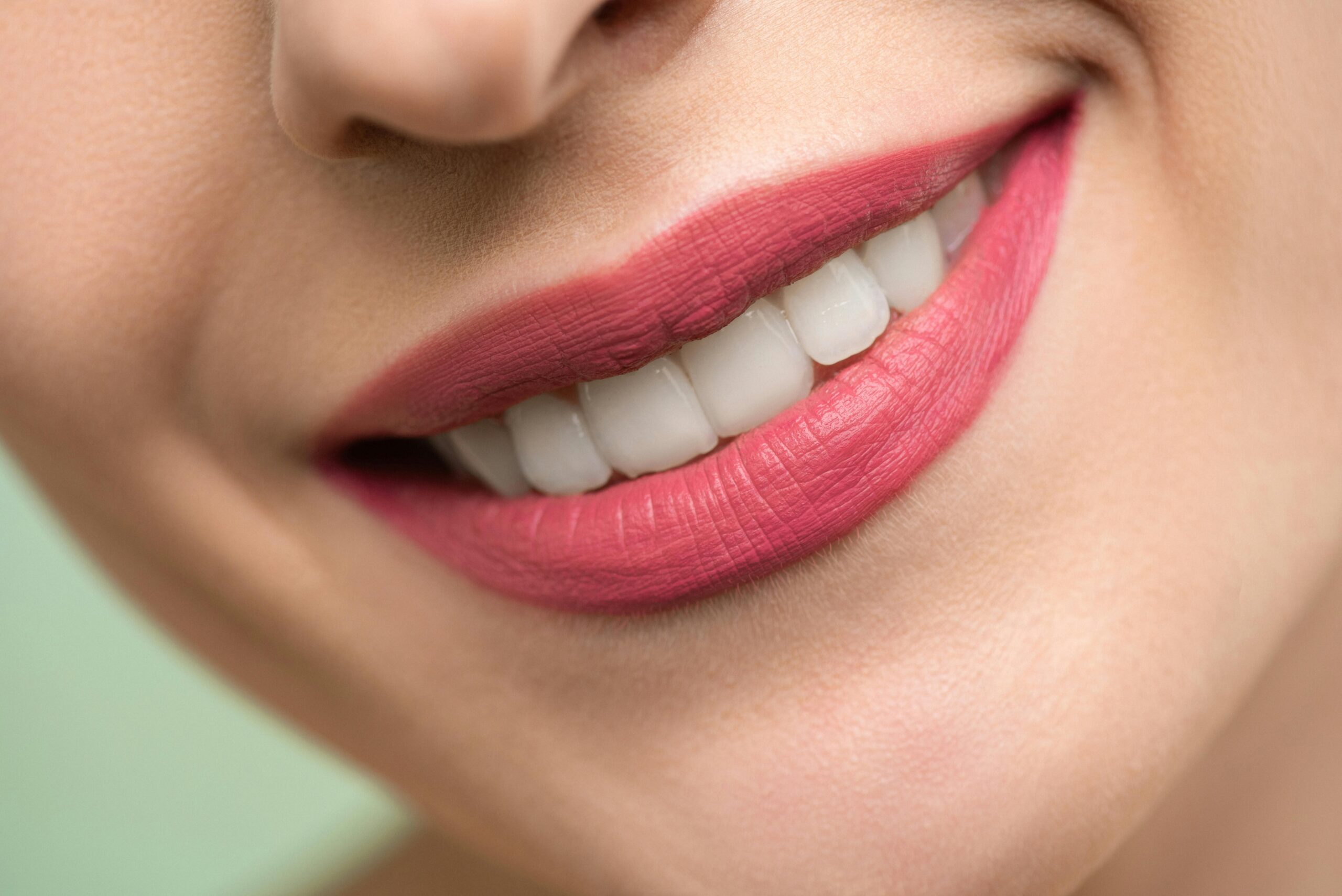 pexels-shiny-diamond-3762453 Sourire éclatant après blanchiment des dents